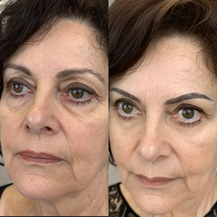 LumaNova Eye Rejuvenator for Red Light and Microcurrent Therapy