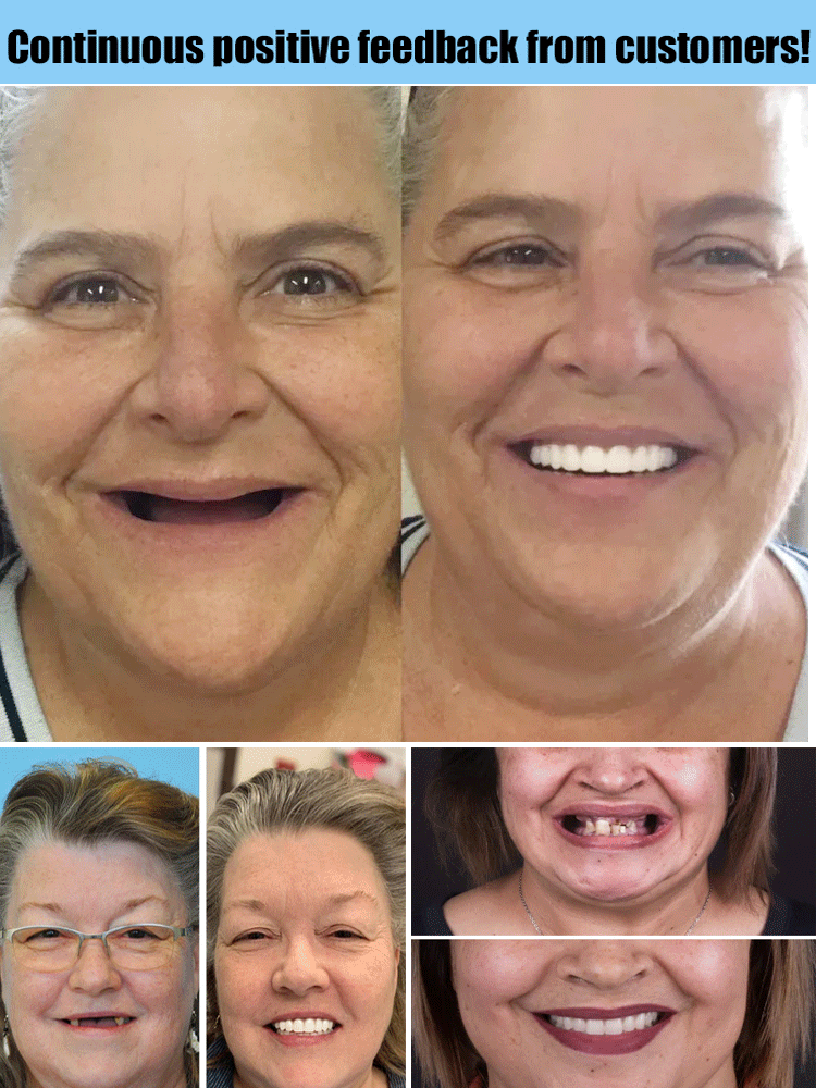 Flexible denture set for upper and lower jaw – reusable & customizable